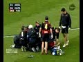 Adelaide Vs Carlton- Rnd 18