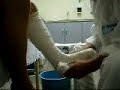 Alinne colocando o gesso ainda Alinne colocando o gesso ainda