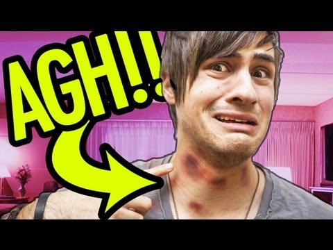 many - Bloopers & MORE: http://smo.sh/hickieXTRAS VOTE FOR ANTHONY'S FOOD: http://smosh.com/FoodVote2013 CHECK OUT THE SMOSH STORE: http://smo.sh/17e8oPy Anthony an...