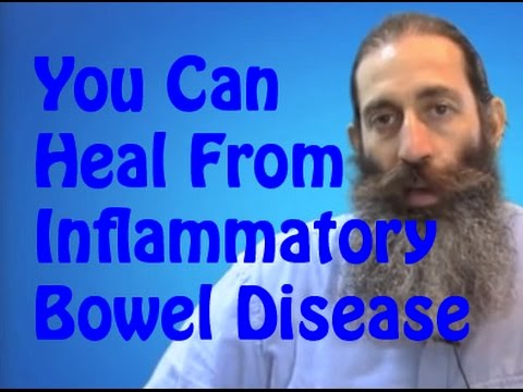 how to control ulcerative colitis flare up naturally