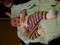 Infantile spasms