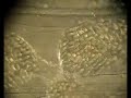 Pinworm (Genus Enterobius) Pinworm (Genus Enterobius)