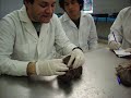 Sistema Digestivo: Higado III
