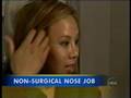 Dr. Rokhsar on the 15 Minute Non Surgical Nose Job
