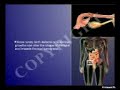 Ectopic Pregnancy causes