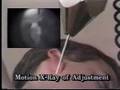 How the Atlas Orthogonal Instrument Works
