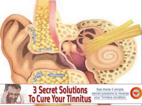 causes of tinnitus and ear ache