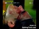 Materazzi elbow vs. Sorin