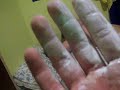 cepillate las bolitas parte 1