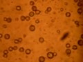 Trypanosoma cruzi en heces de chinche. fase Tripomastigote metacíclico