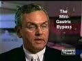 Mini-Gastric Bypass Animation Mini-Gastric Bypass Animation
