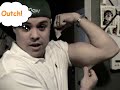 Diabetes How to do an Insulin Shot in Your Arm Diabetes How to do an Insulin Shot in Your Arm
