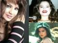 جميلات لبنان قبل وبعد عمليات التجميل