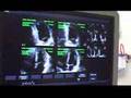 Cardio-3D