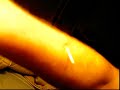 How to pierce thick skin