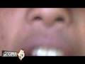 El acento Entrevistado por zona5  Part1