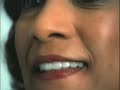 Invisalign at Fry Orthodontics Specialists