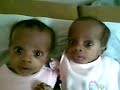 Ai'Maya  Alexis at the doctor;s office on March 7, 2008