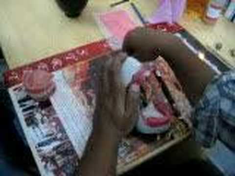 Denture Setup