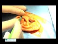 Chirurgie RETROX/RETROX Surgery