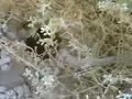 سبحان الله ماذا فعل هذا الميت في حياته حتى تكون الحيات هي ضيوفه في قبره بئس الضيوف احرص على ان يكون ضيفك عملك الصالح قبل فوات الأوان وتب الى الله قبل انقطاع العمل