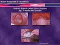Modern Management of Endometriosis - Mr Trehan
