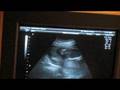 videos de The Next Artie