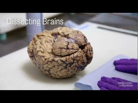 dissection - Martha Henson, 2012. Digital video (7 minutes) On Wednesdays at Hammersmith Hospital in London, a few recently preserved human brains are dissected according...