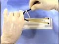 Sutures
