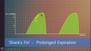 Advenced course - ETCO2 monitoring - 동아의대 정진우 교수님