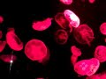 sea jelly