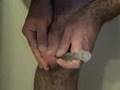 Knee Draining #1 (be sure to see #2 - it's better)