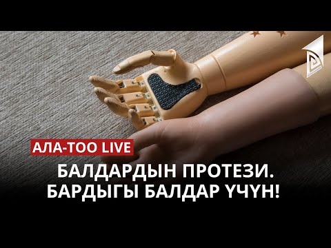 Балдардын протези. Бардыгы балдар үчүн! | 24.04.2023
