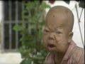 Hình minh họa 1