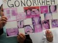 Click here to watch this video gonorrhea.AVI
