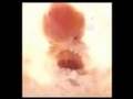 Abortion: Personhood of the Unborn, Your Comments Answered