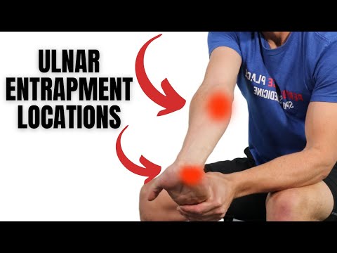 how to relieve ulnar nerve compression