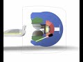 CJW GAMMA KNIFE