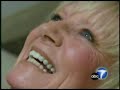 Dr.Payam Ataii, ABC Gum Disease Dr.Payam Ataii, ABC Gum Disease
