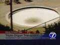 YouTube - Disemboweled Girl Gets 3 New Organs