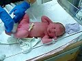 After a little body wash, the nurse toweled down Meg's bottom and then put a fresh diaper on.  Meg wasn't sure what to make of it all.