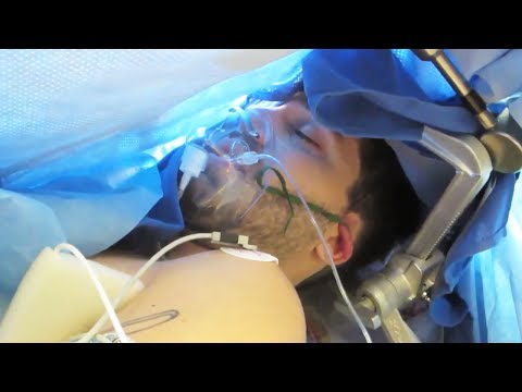 surgery - Just to be clear this video is NOT intended to shock or scare its to educate and to commemorate the amazing medical doctors, surgeons, nurses that save lives...