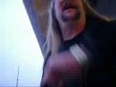 HILARIOUS Drunk bum & Tommy Lee fan goes crazy shows ass HILARIOUS Drunk bum & Tommy Lee fan goes crazy shows ass