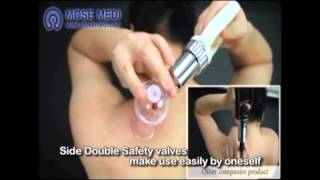 video thumbnail Cupping Devices - Samrt Cupping (SE/PE) youtube