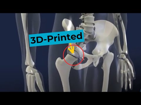 additive - We're working on developing the applications of difficult-to-machine metals, including titanium and its alloys, nickel, and cobalt chrome alloys. We recently...