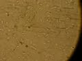 Flagellate in Dog Feces