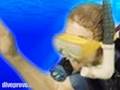 Ansel gets underwater Plastic Surgery