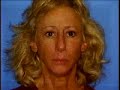 Ex-Homecoming Queen Beats Sister With Fake Leg In Trailer Ex-Homecoming Queen Beats Sister With Fake Leg In Trailer