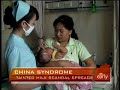 China's Tainted Milk Nightmare