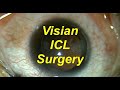 Visian ICL implantable contact lens and bioptics 5-16-11. Shannon Wong, MD